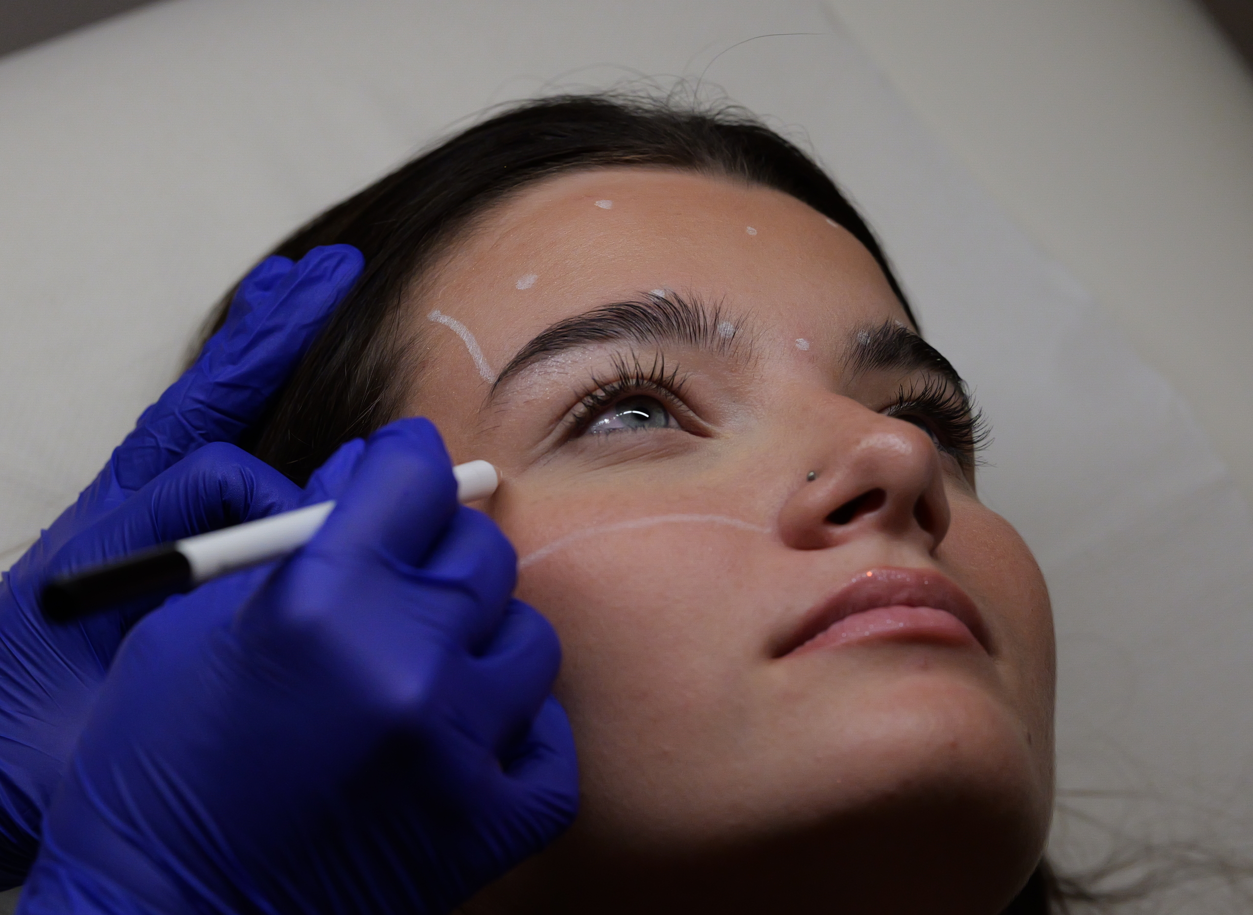 skin boosters drc treats patient seven