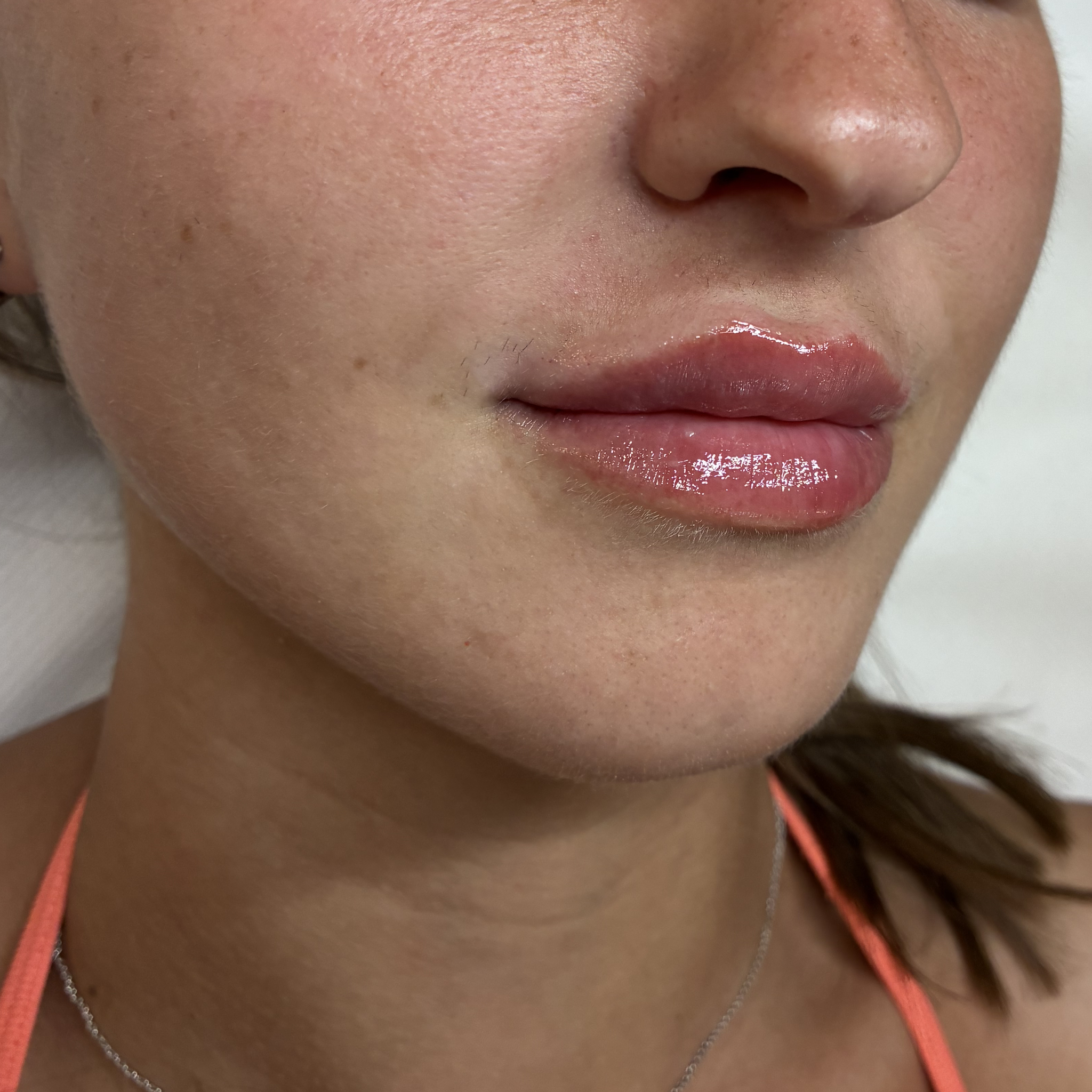 lips eight right after