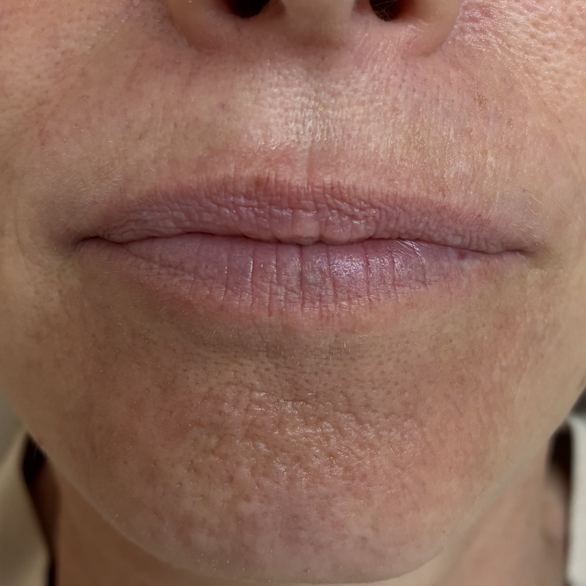 lips eleven front before