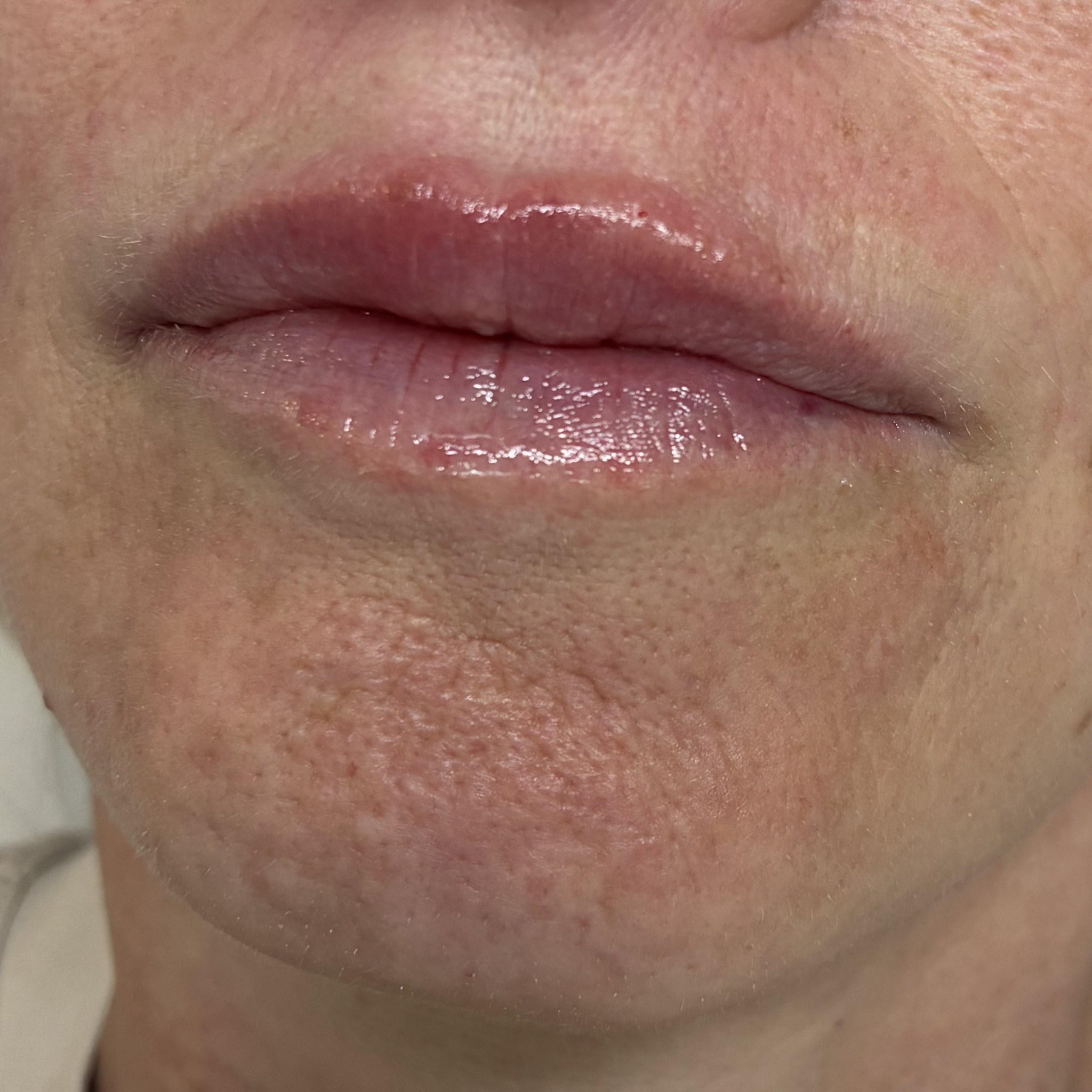 lips eleven left after