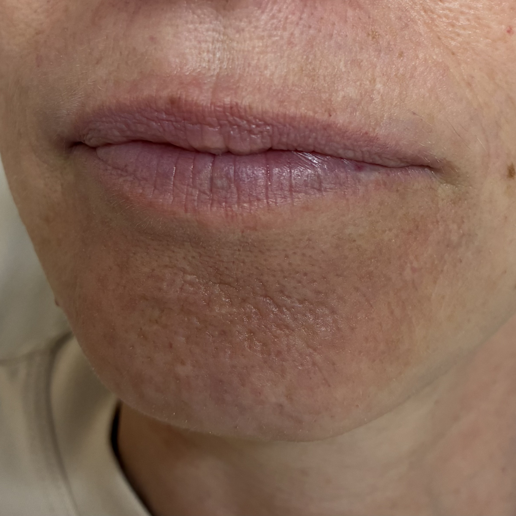 lips eleven left before