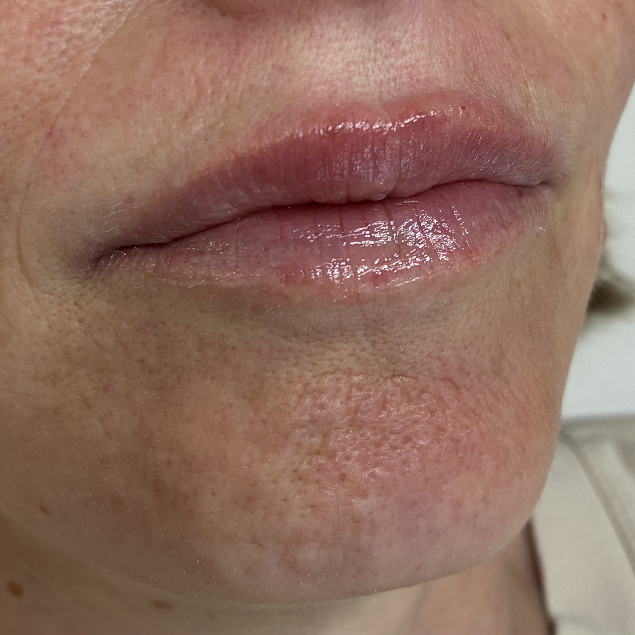 lips eleven right after