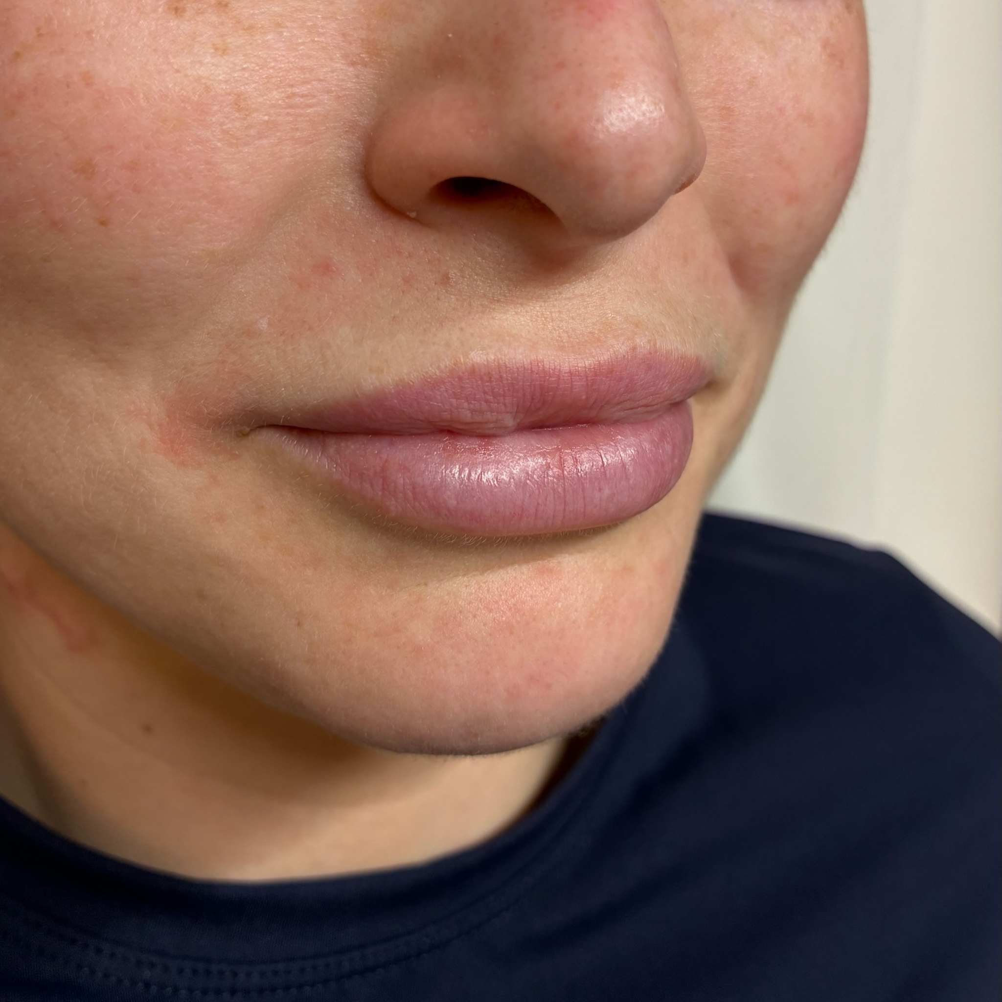 lips five right before