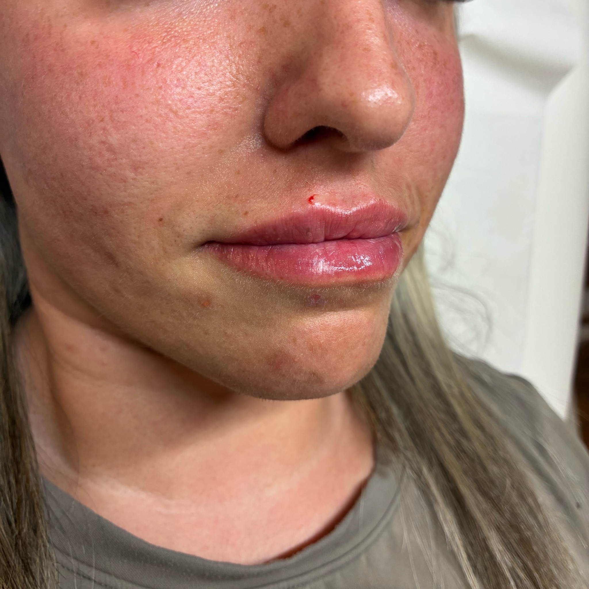 lips four right after