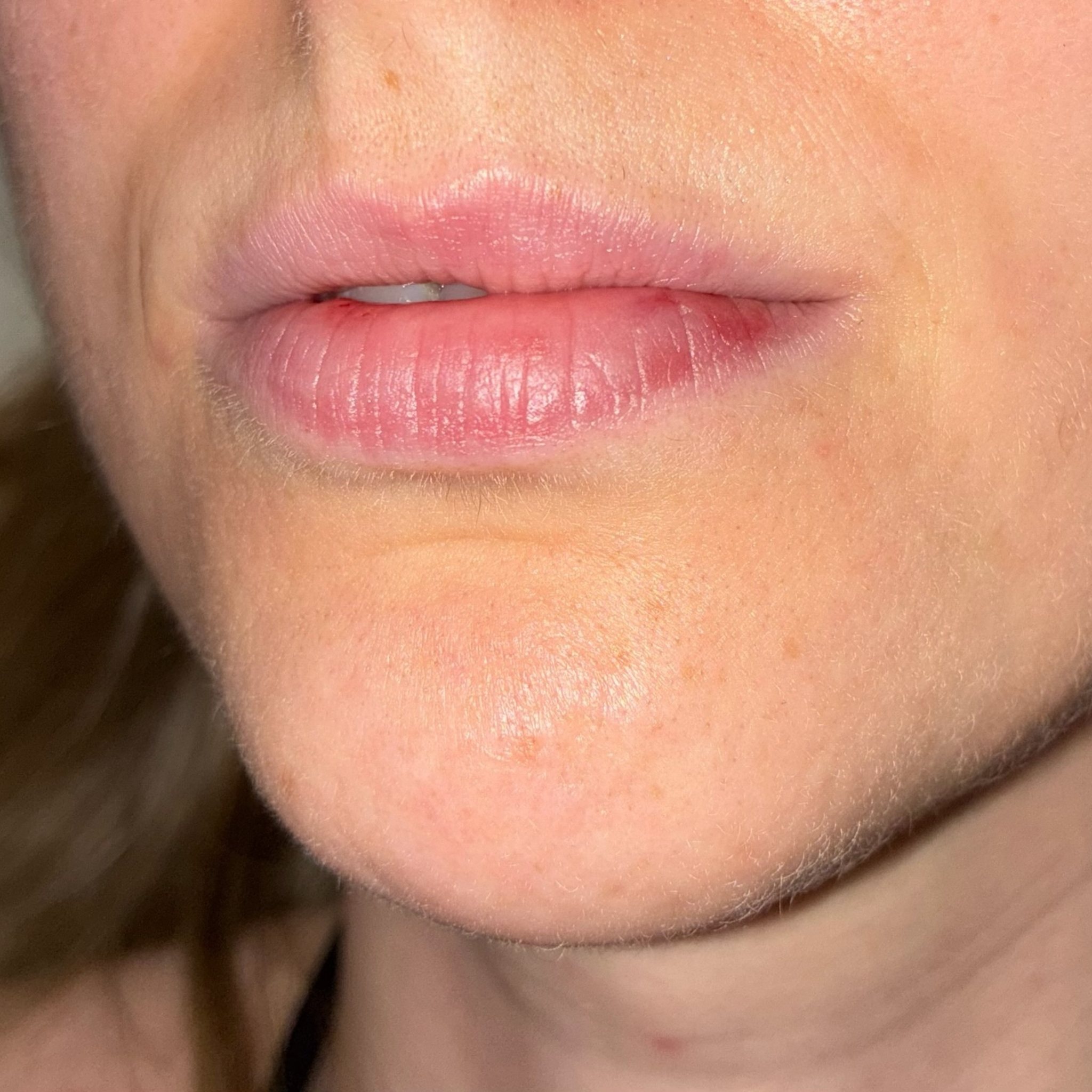 lips nine left before