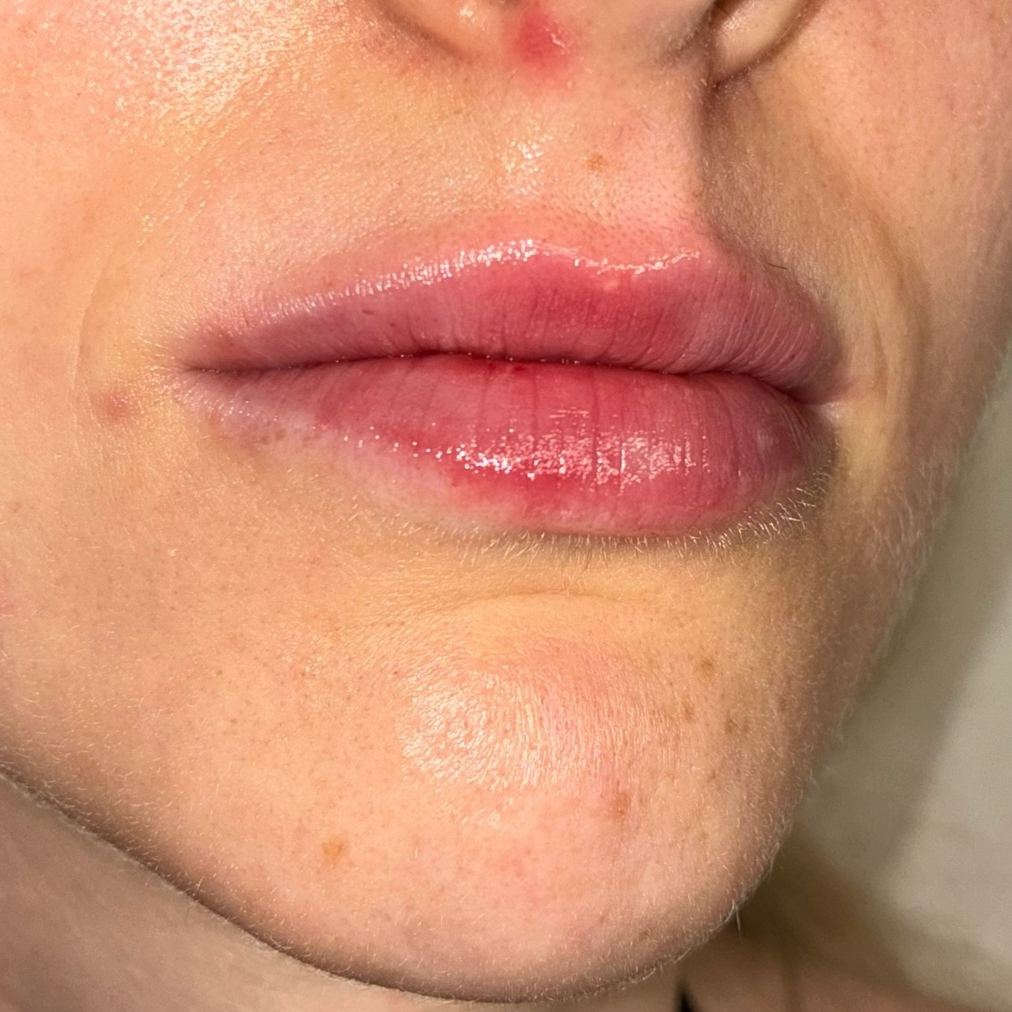 lips nine right after