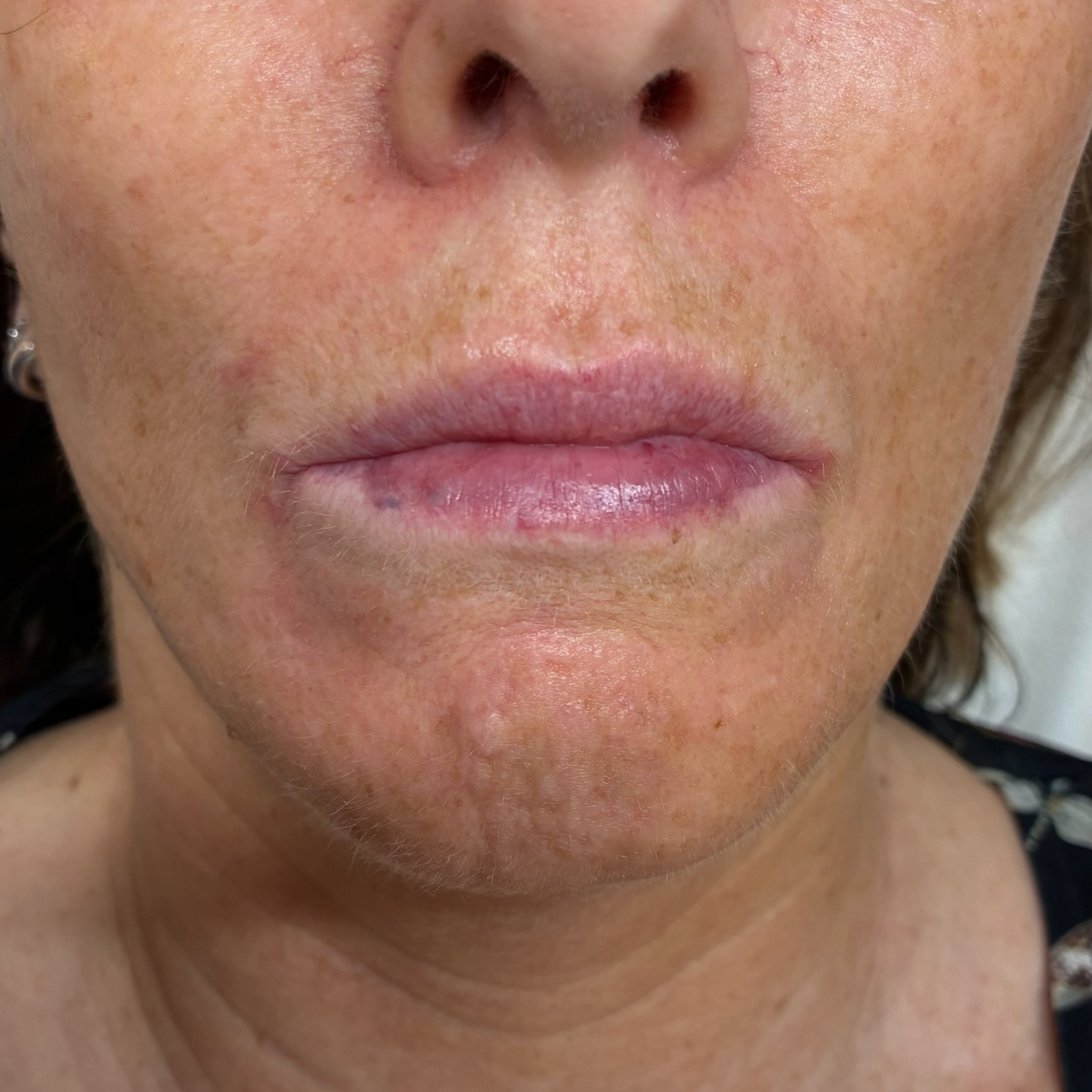 lips seven front before