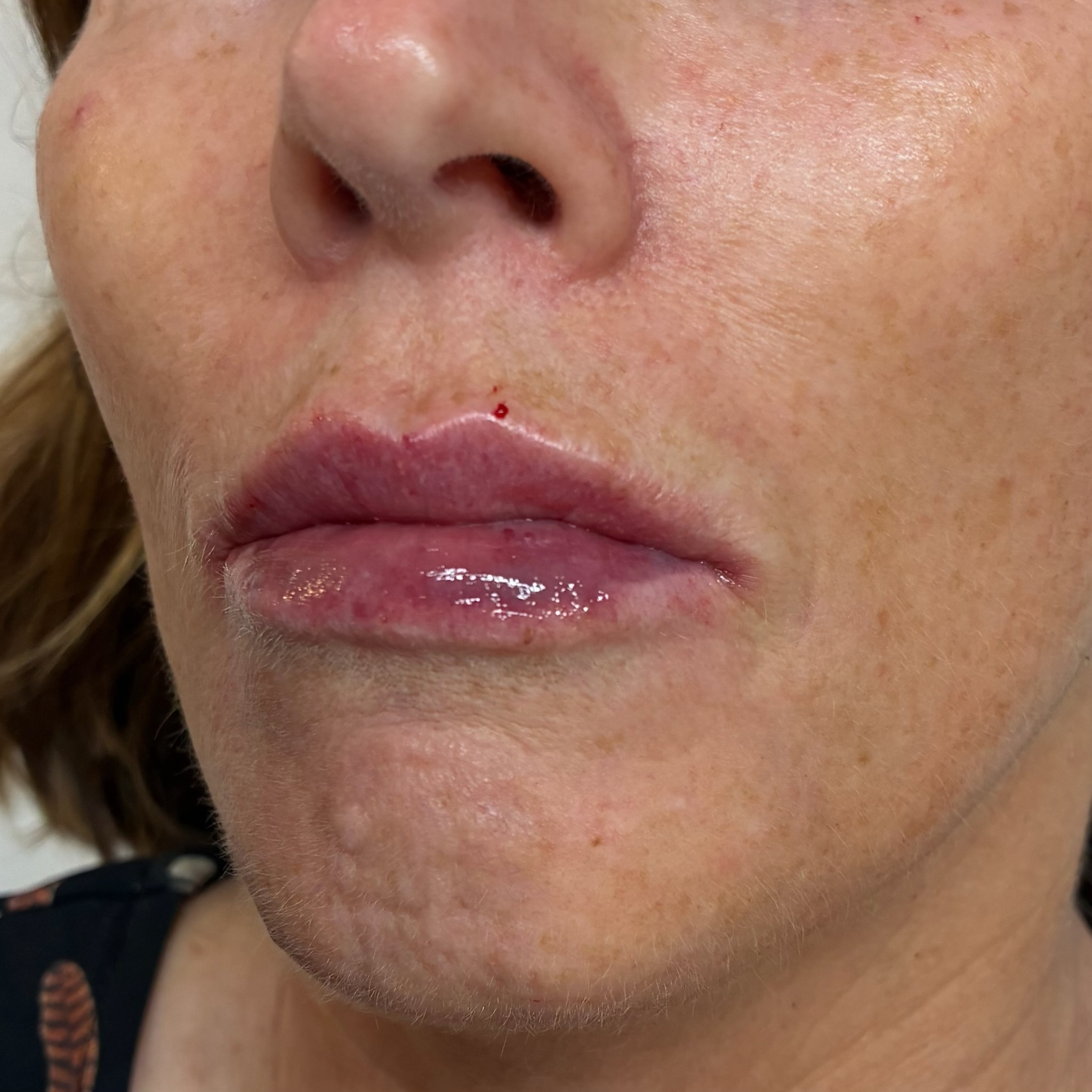 lips seven left after