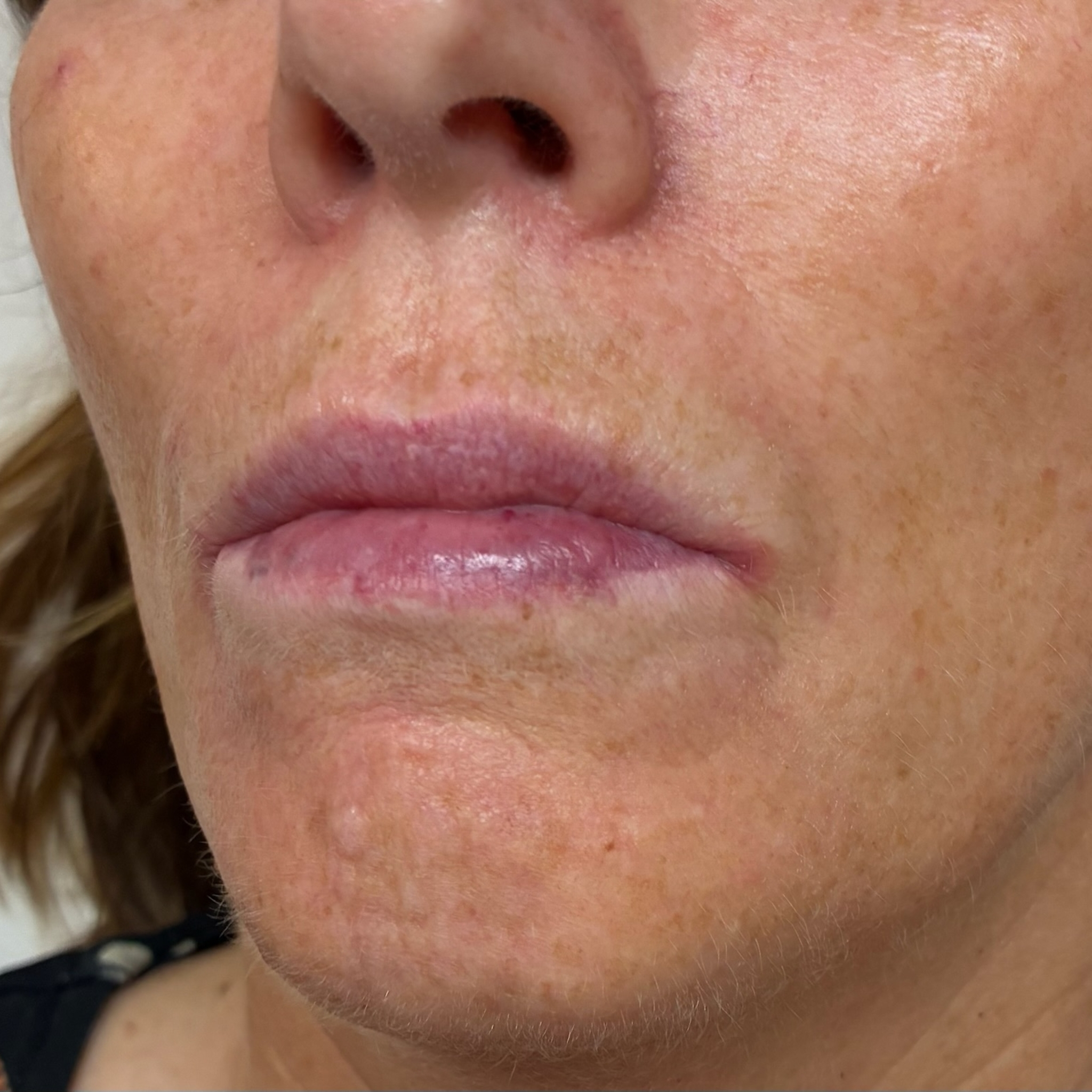 lips seven left before