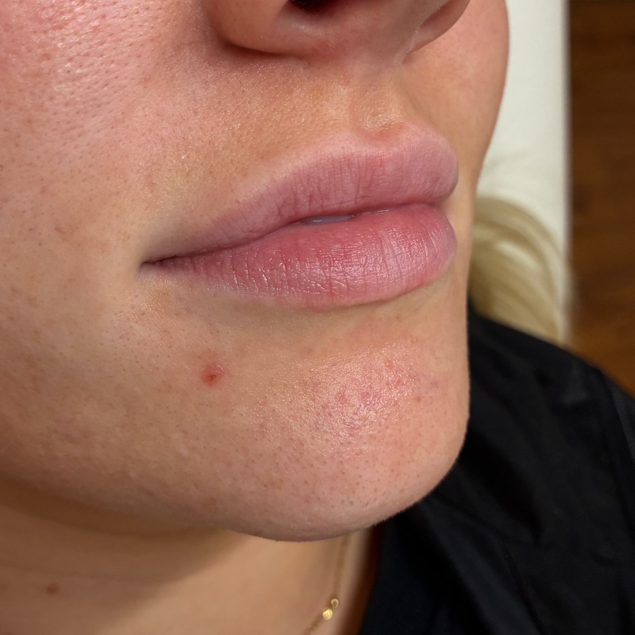 lips six right before