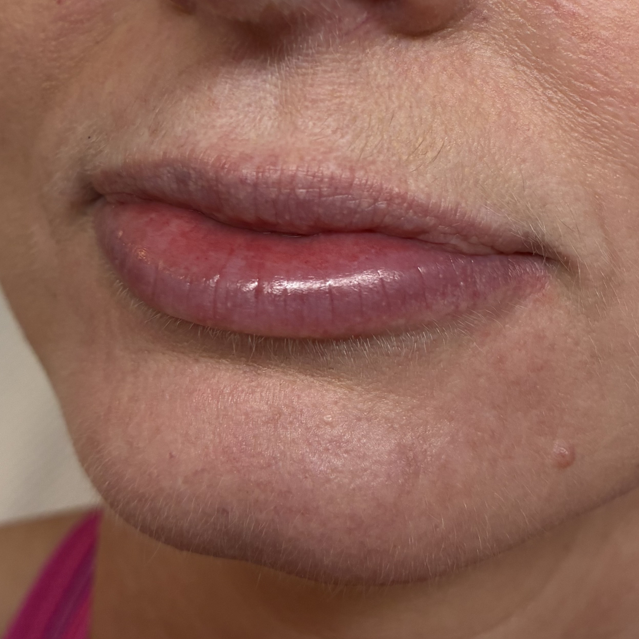 lips ten left before
