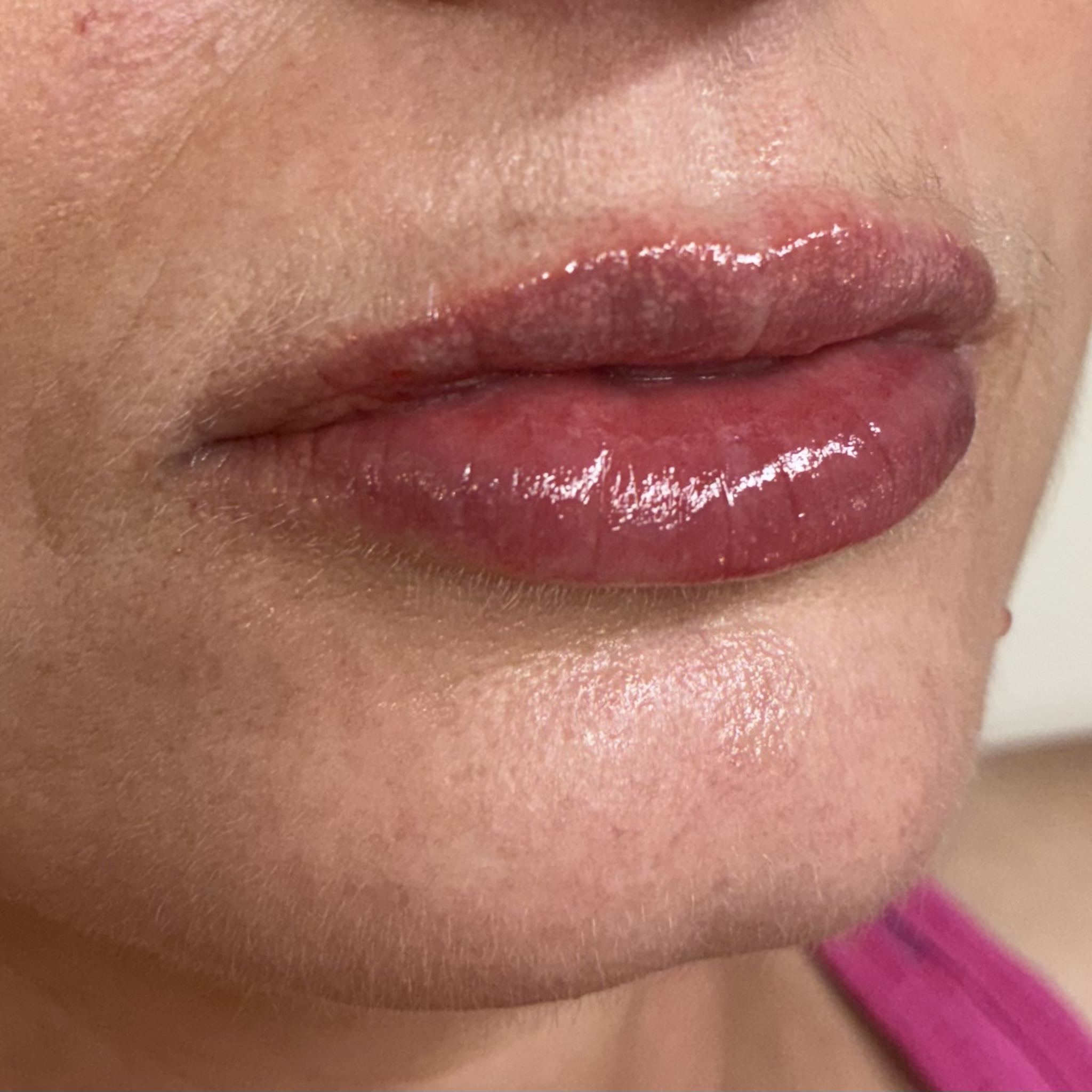 lips ten right after