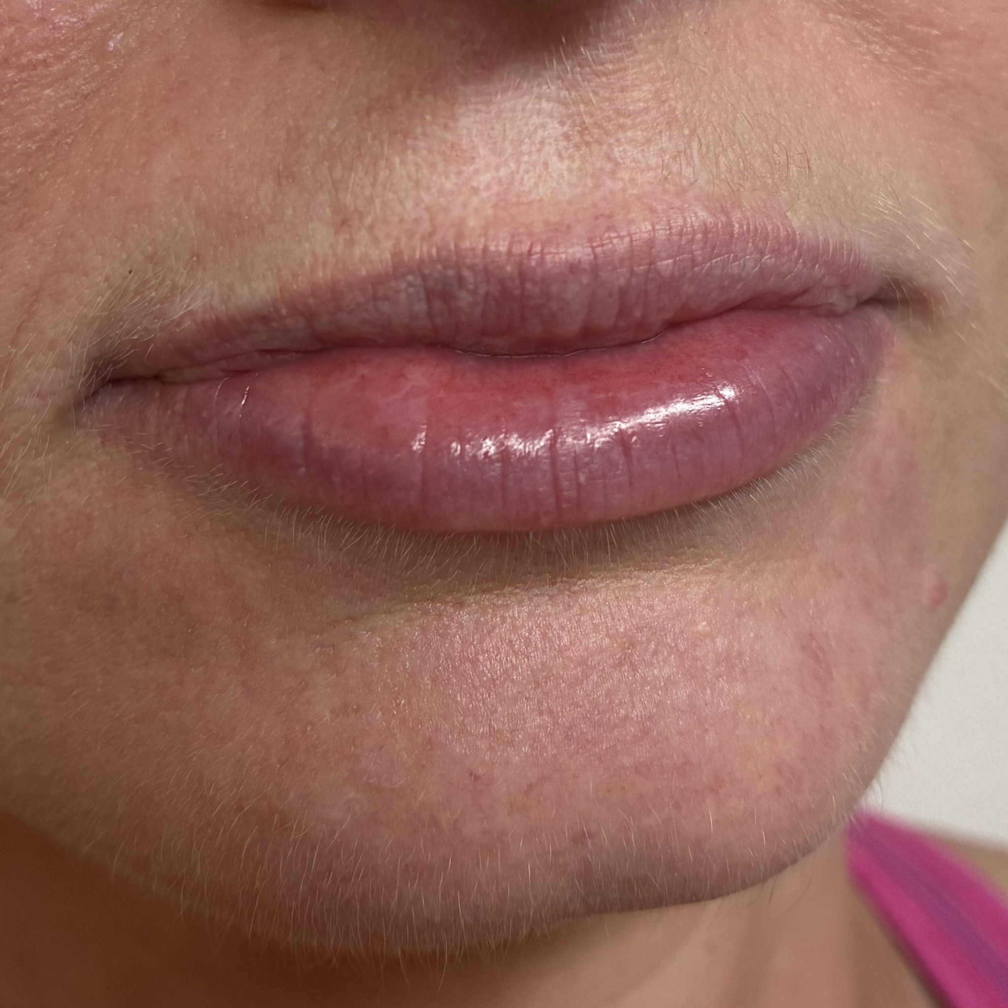 lips ten right before