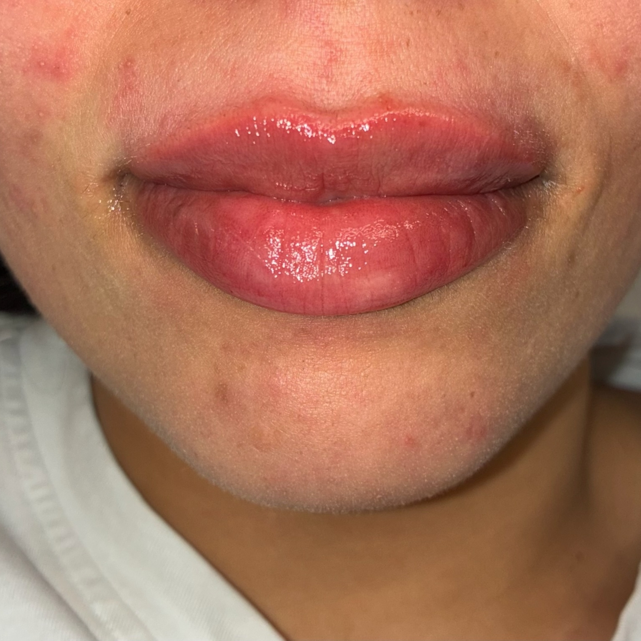 lips thirteen front after