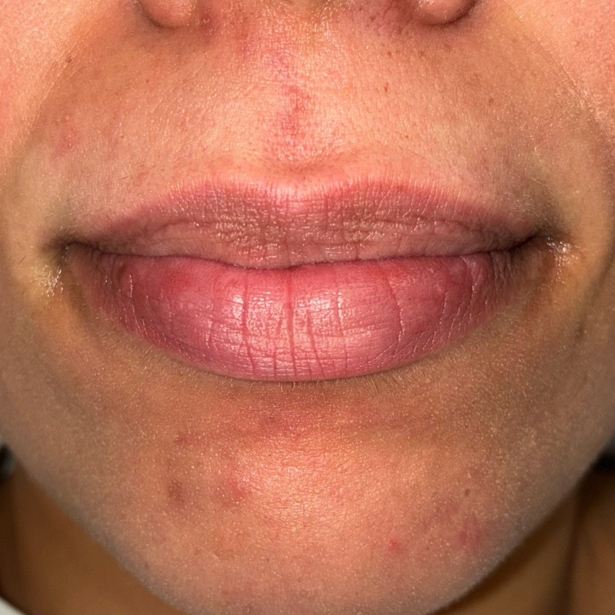 lips thirteen front before