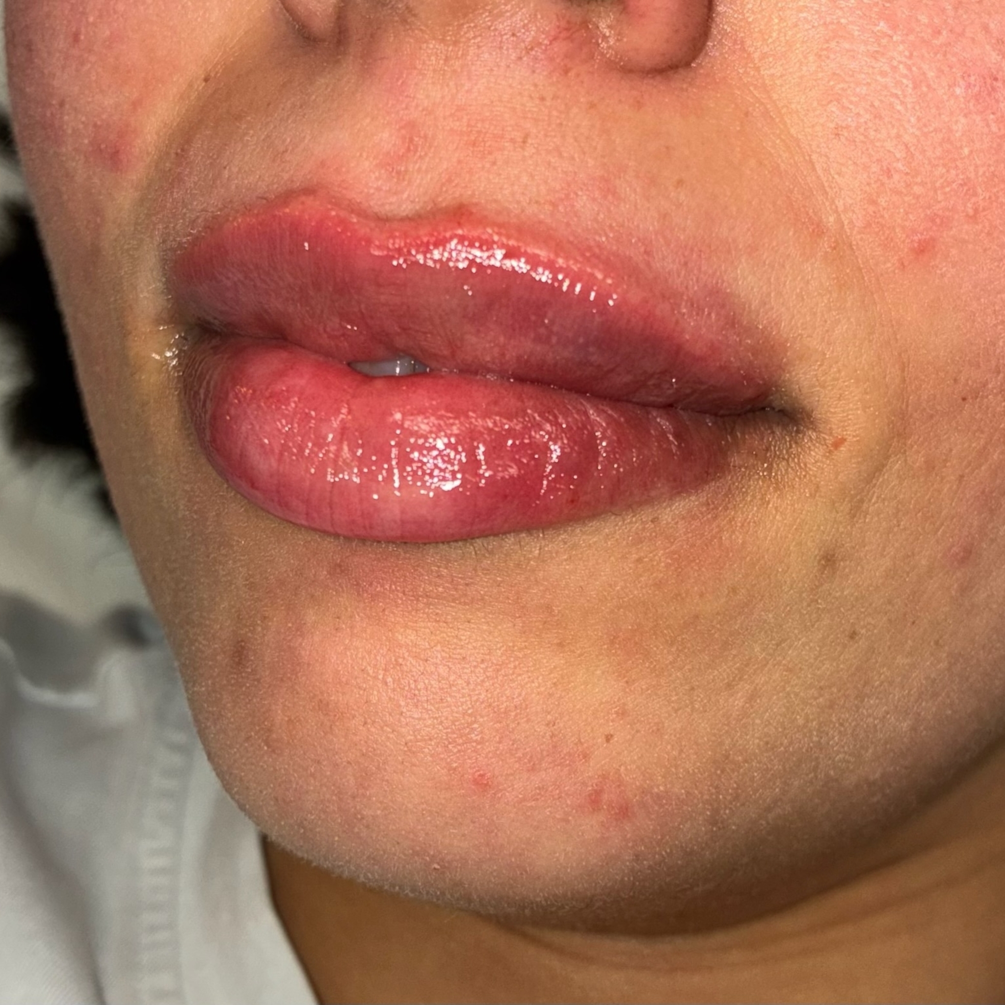 lips thirteen left after