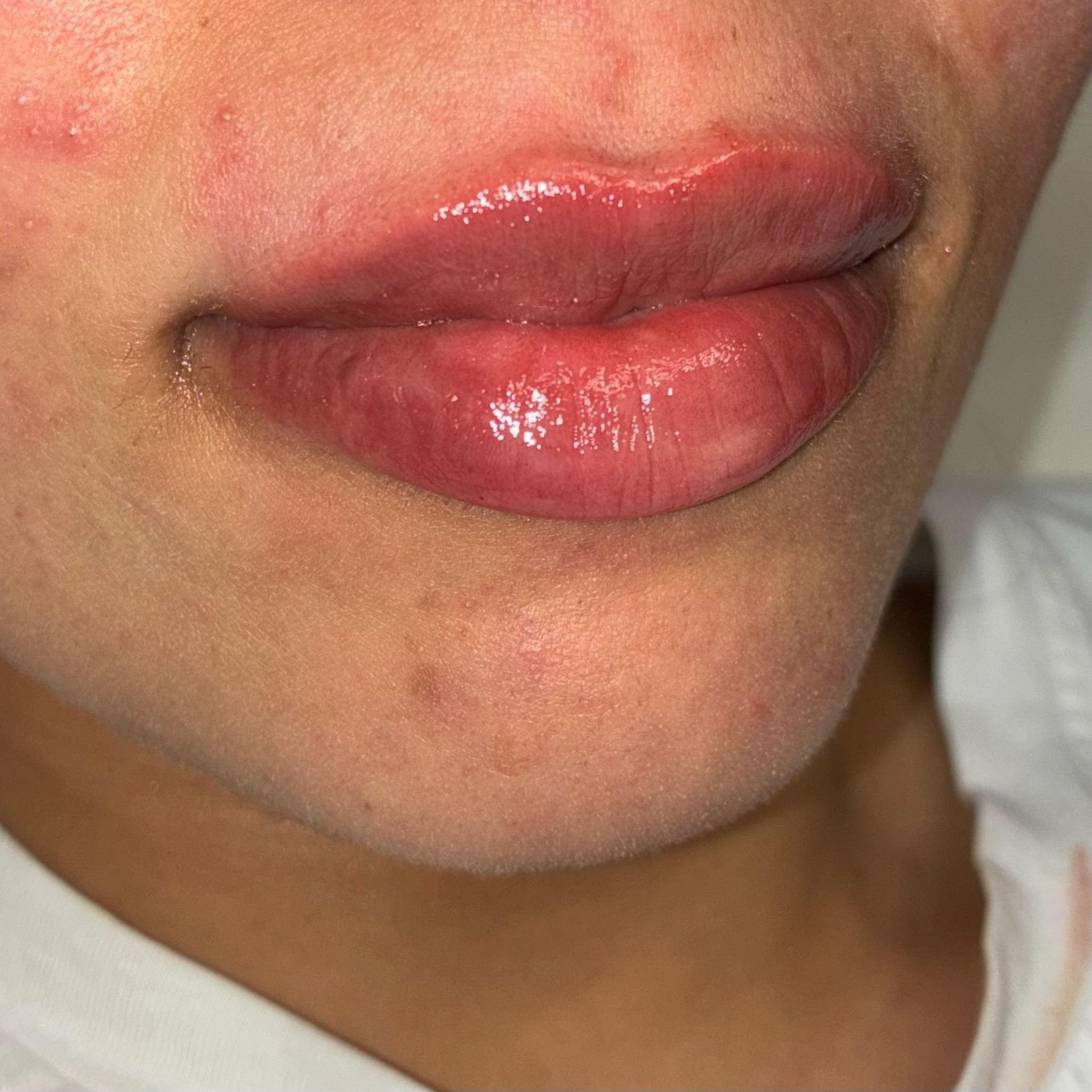 lips thirteen right after