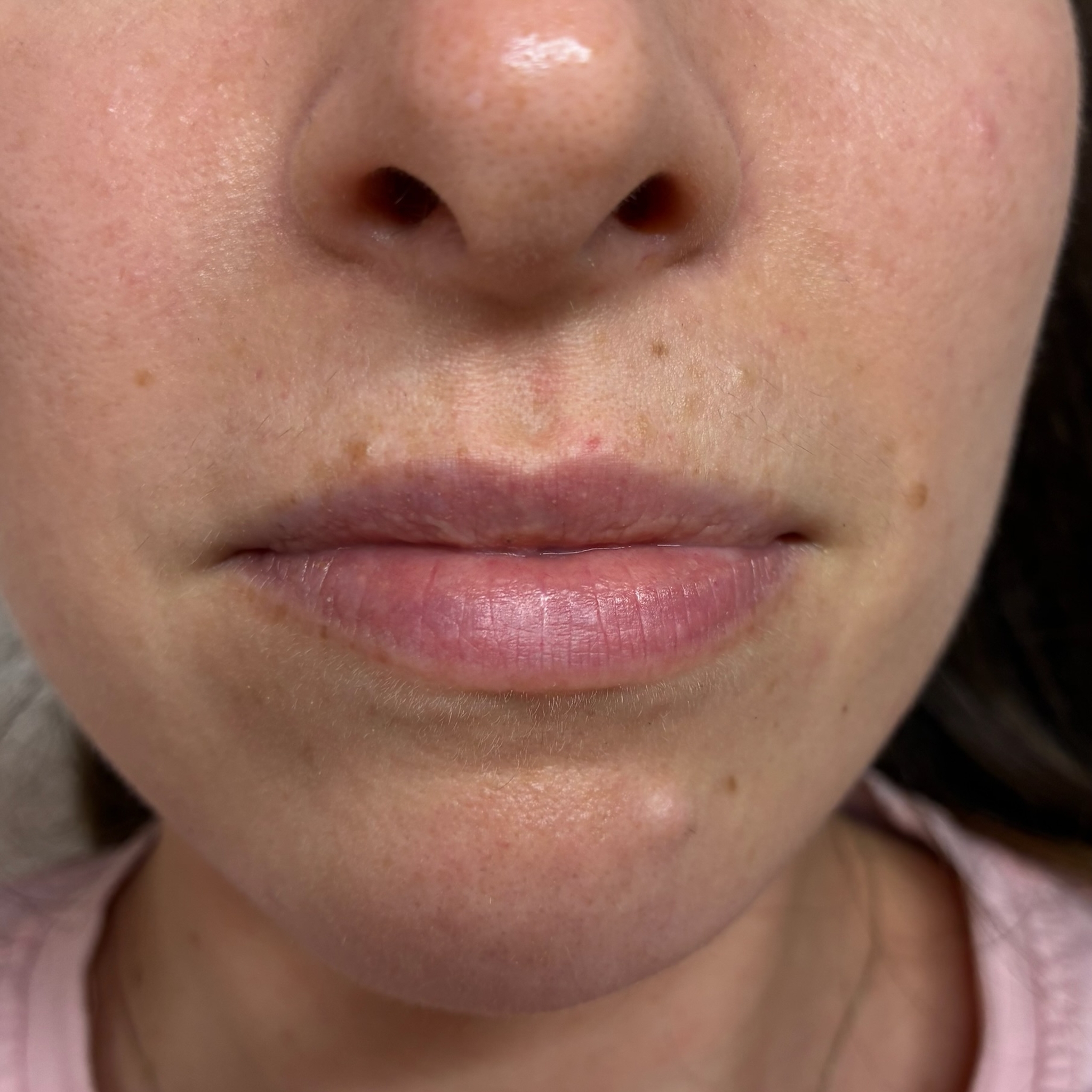 lips three front before