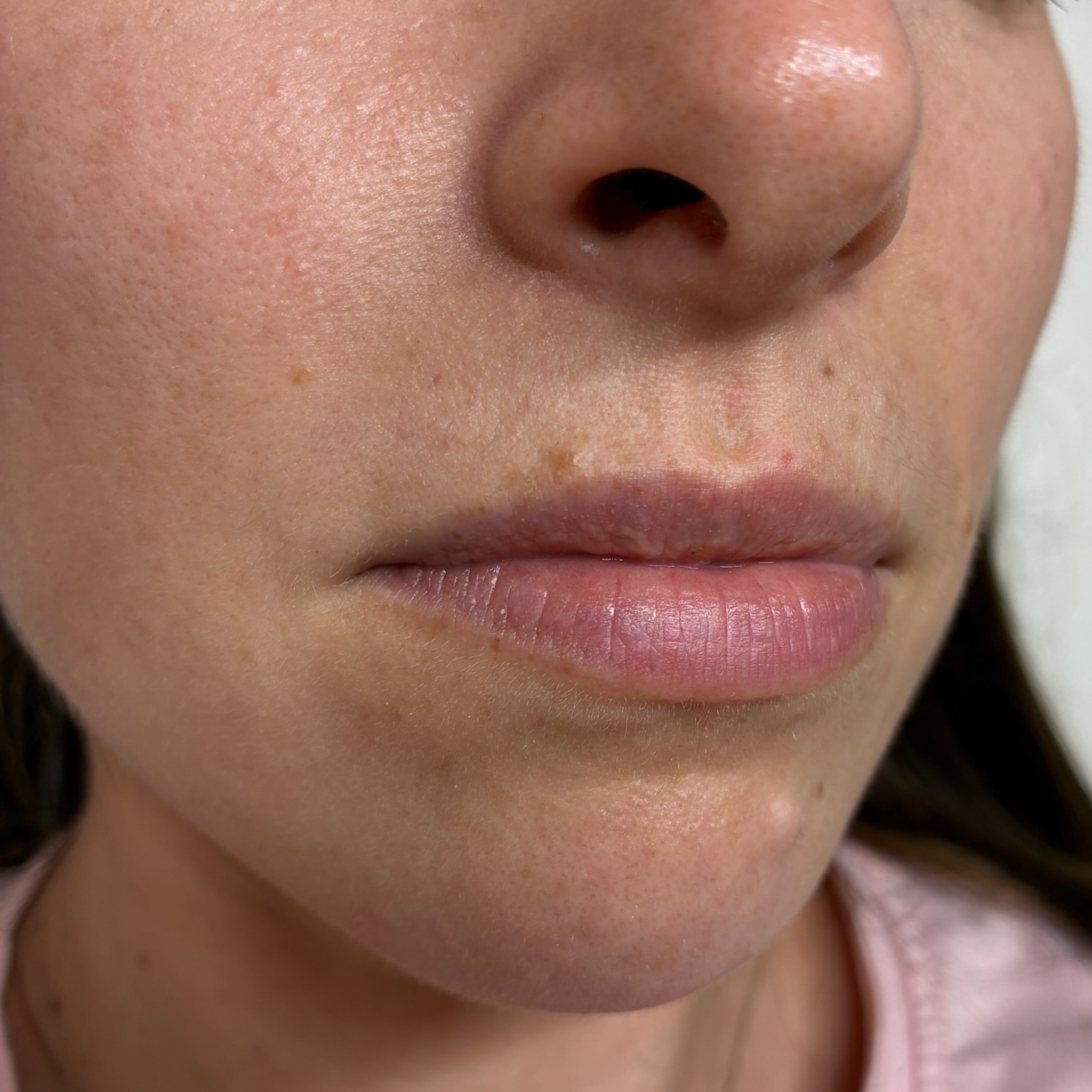 lips three right before