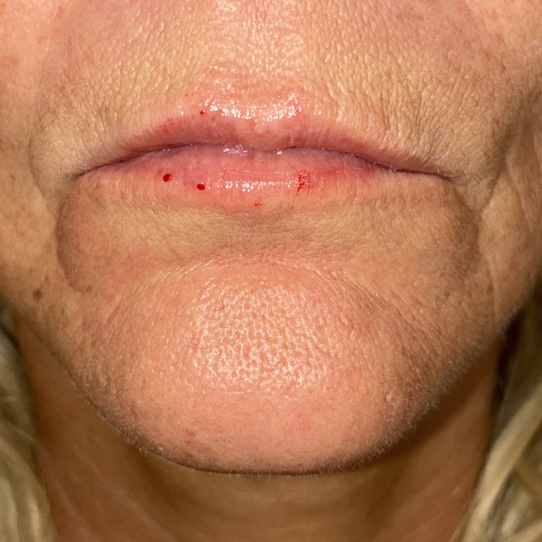 lips twelve front after