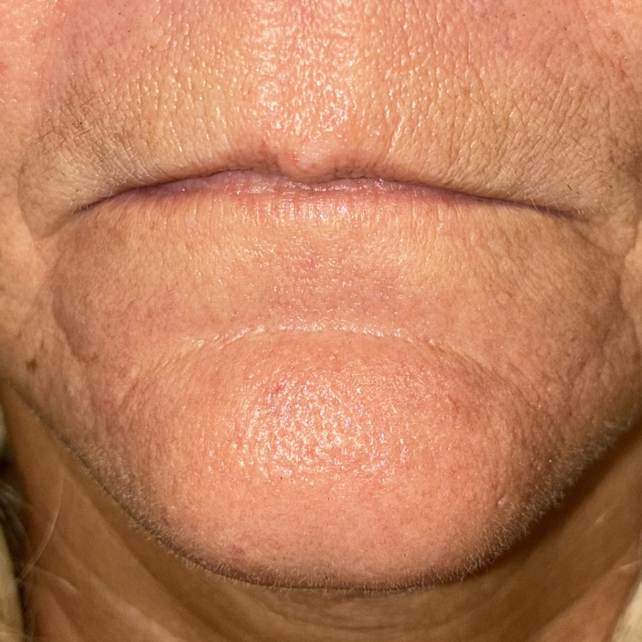 lips twelve front before