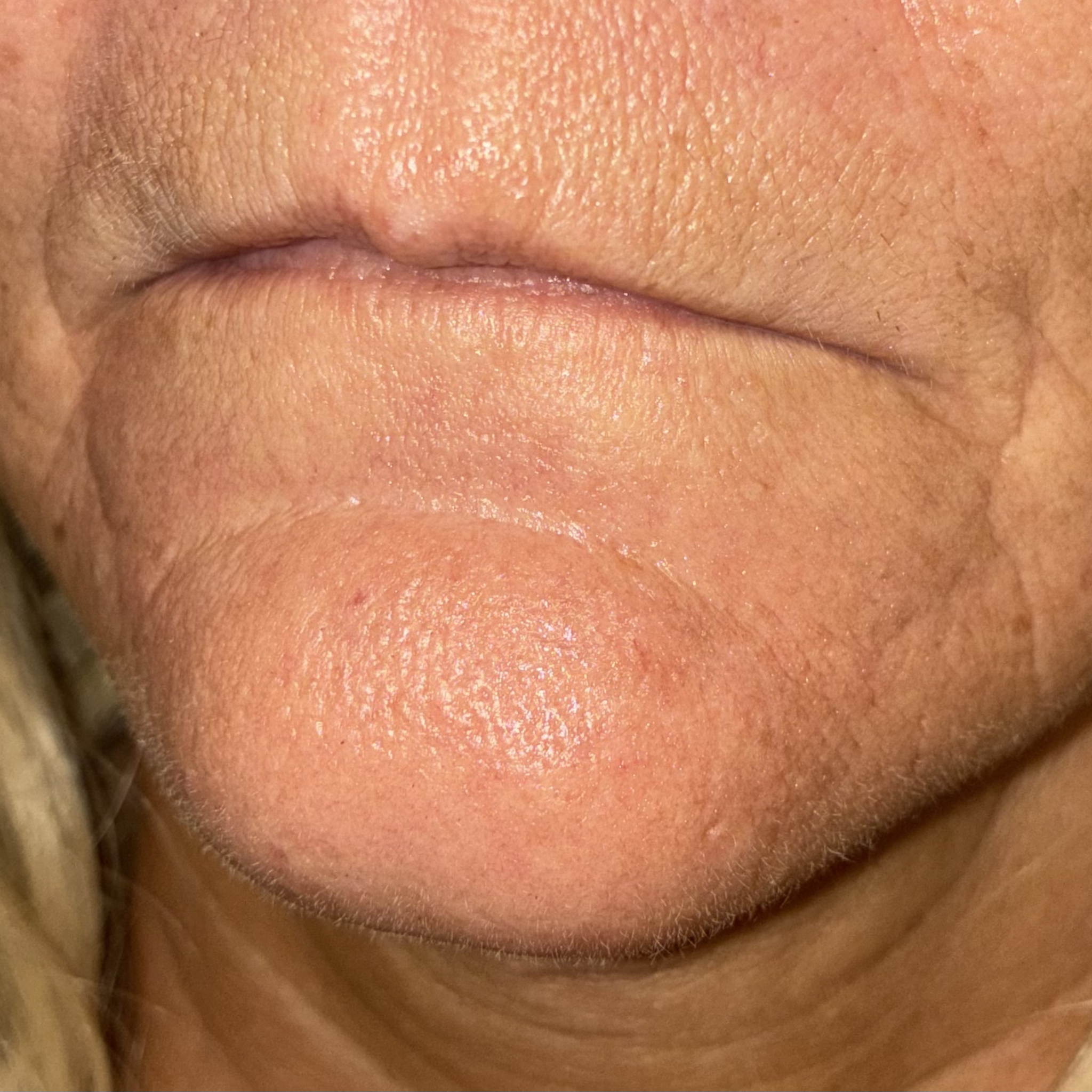 lips twelve left before