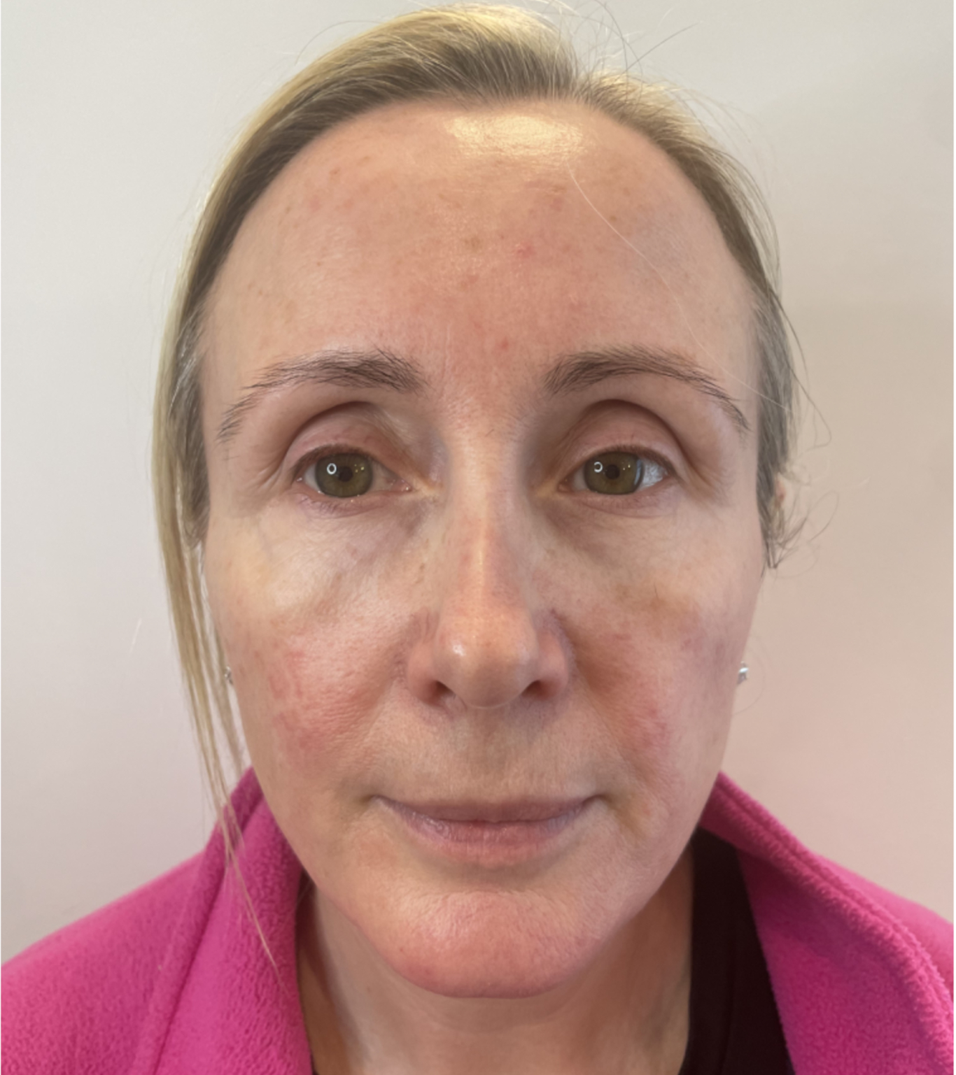 obagi skincare after