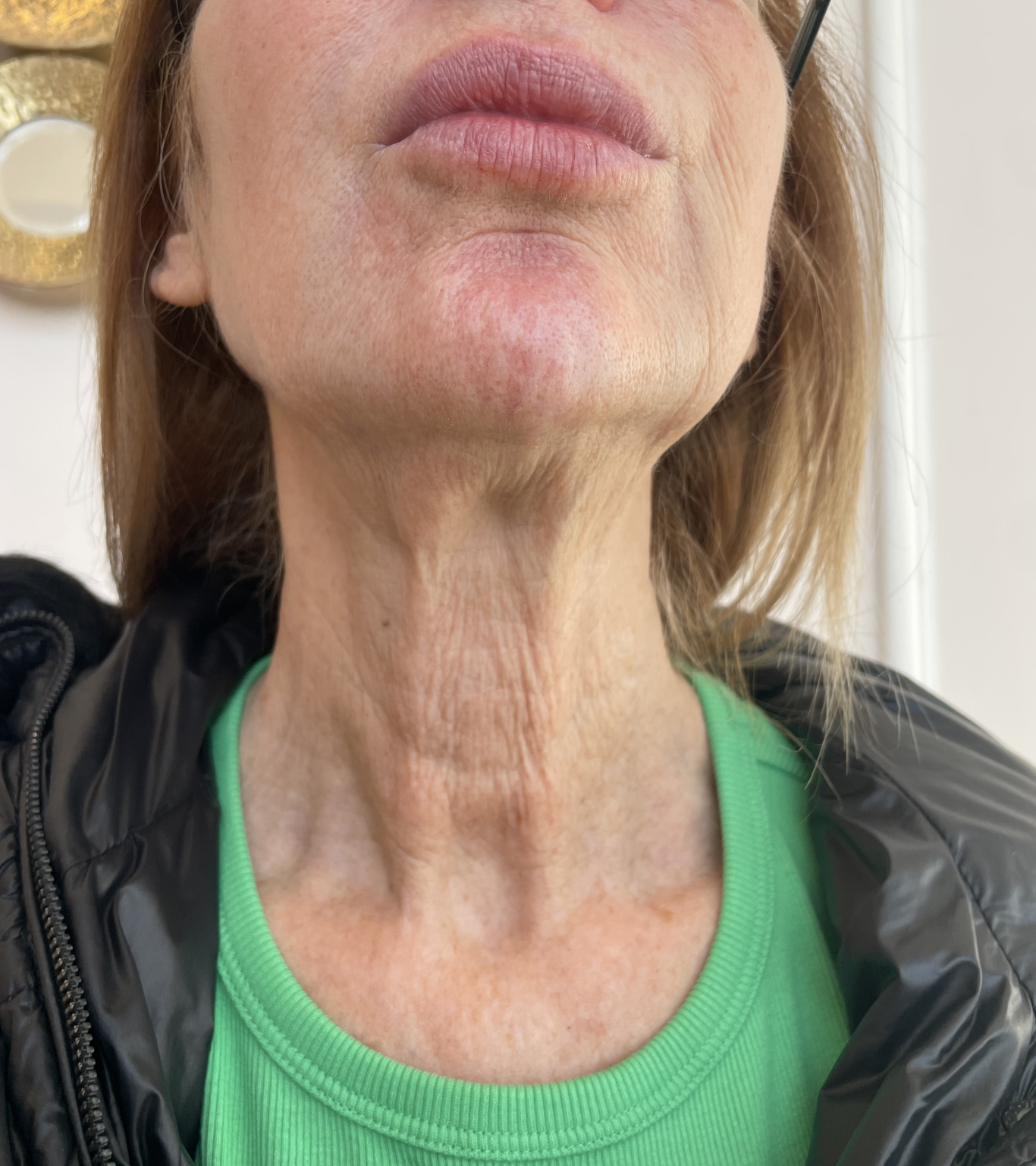 polynucleotides neck after front