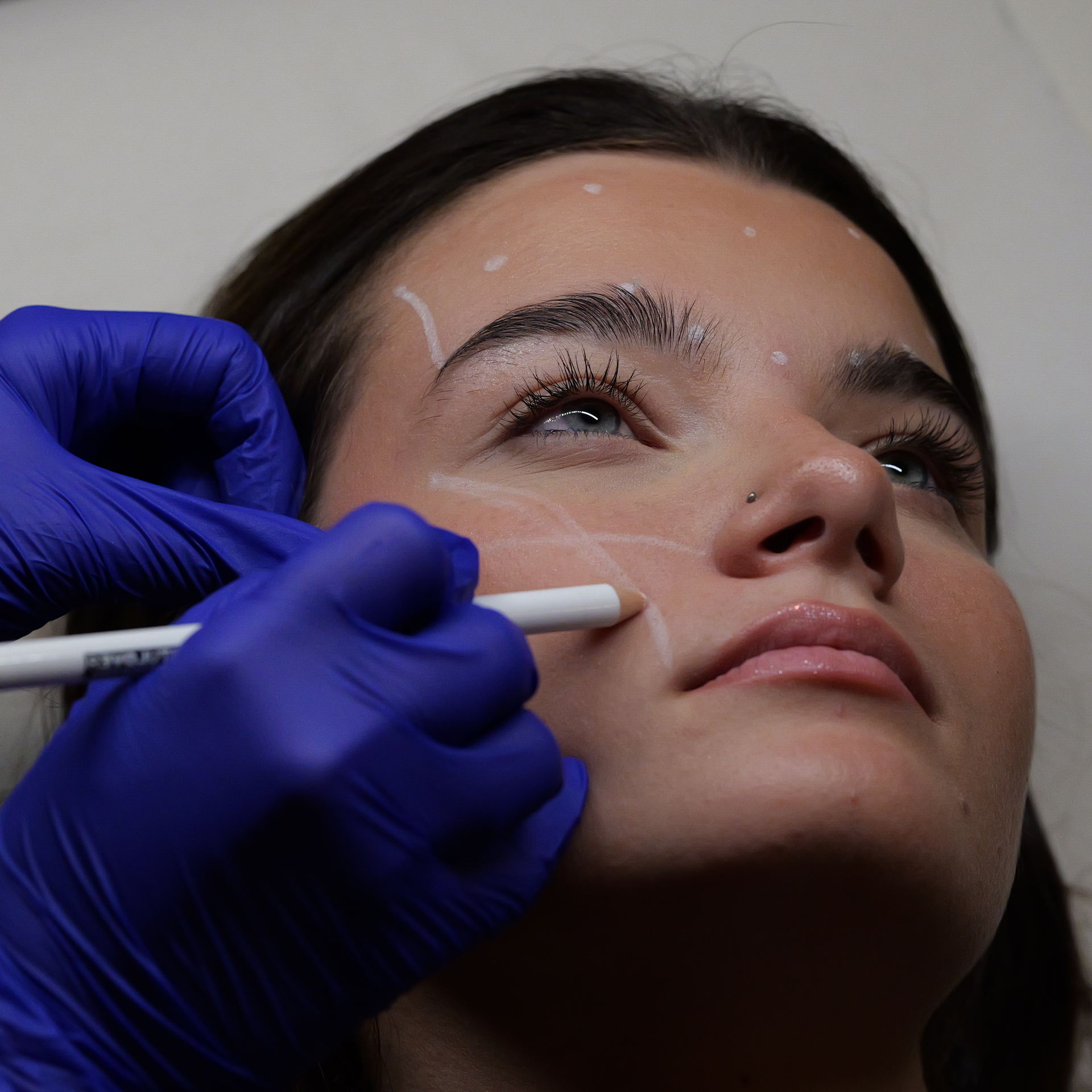 treatment card eight