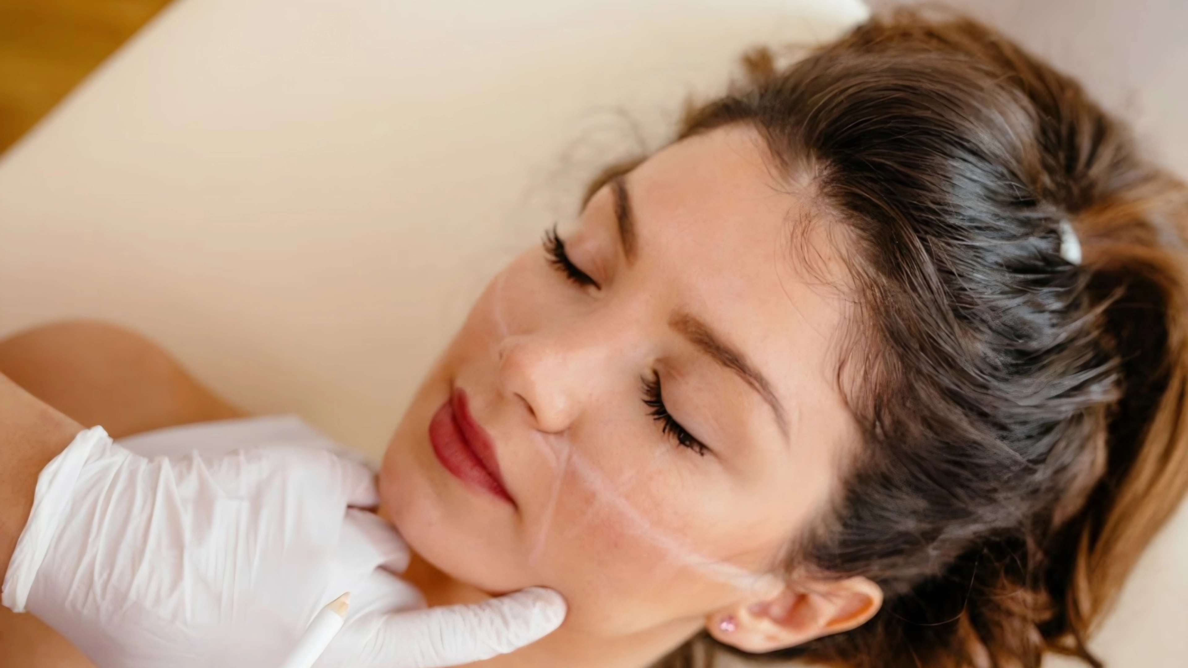 dermal fillers image two